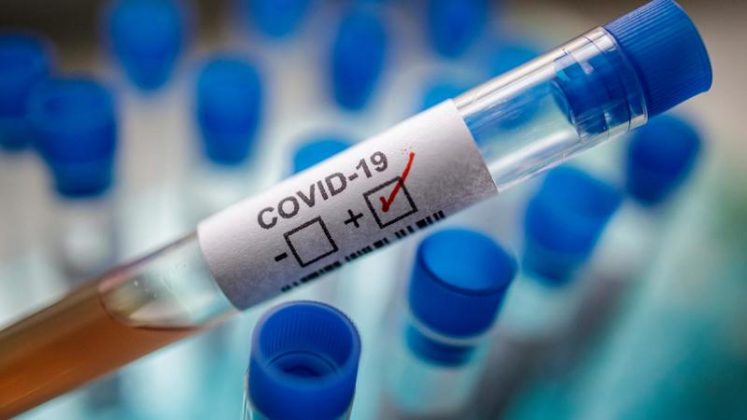 Questions to Ask About a Positive COVID Test Cycle