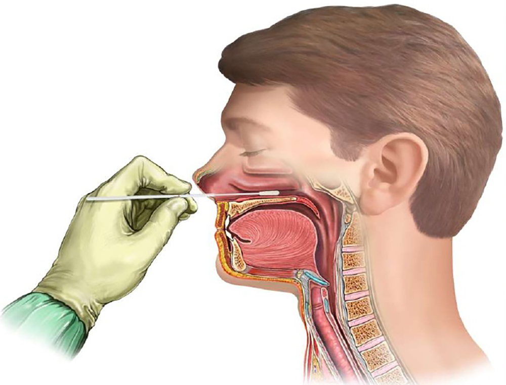 Через нос ртом делайте. Забор материала из носоглотки.